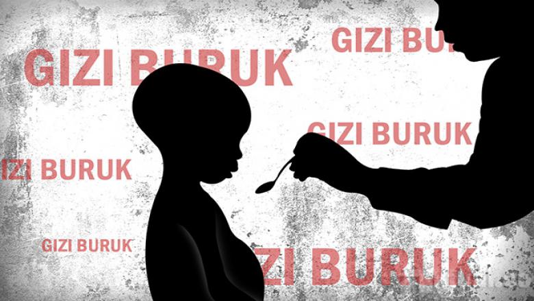 Dinkes Klaim, Penderita Gizi Buruk di  Bojonegoro Terus Menurun